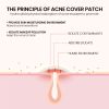 Pimple Patches,Pimple Patches For Face, Hydrocolloid Acne Patches, Cute Star Stickers Hydrocolloid Acne Pimple Patch For Covering Zits And Blemishes