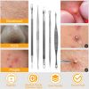 5 Pcs Blackhead Remover Kit Pimple Comedone Extractor Tool Set Stainless Steel